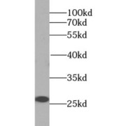 WB analysis of PC-3 cells, using IGF1B-Specific antibody (1/500 dilution).