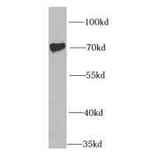 WB analysis of Jurkat cells, using IGF2BP1 antibody (1/1000 dilution).