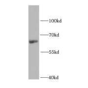 WB analysis of human kidney tissue, using IGF2BP2 antibody (1/1000 dilution).