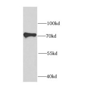 WB analysis of HepG2 cells, using IGF2BP3 antibody (1/1000 dilution).