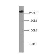 WB analysis of HepG2 cells, using IGF2R-Specific antibody (1/500 dilution).