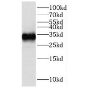 WB analysis of HeLa cells, using IGFBP2 antibody (1/300 dilution).