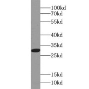 WB analysis of A2780 cells, using IGFBP3 antibody (1/100 dilution).