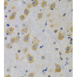 Insulin Like Growth Factor Binding Protein 4 (IGFBP4) Antibody