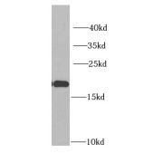 WB analysis of HepG2 cells, using IGFBP4 antibody (1/1000 dilution).