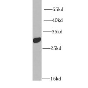 WB analysis of mouse liver tissue, using IGFBP5 antibody (1/1000 dilution).