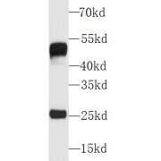 WB analysis of human plasma tissue, using Human IgG antibody (1/5000 dilution).