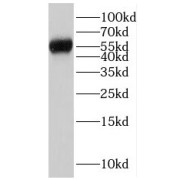 WB analysis of human plasma (0.3ug) tissue, using human IgG heavy chain antibody (1/1000 dilution).