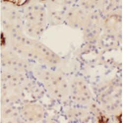 Immunoglobulin Superfamily Member 11 (IGSF11) Antibody