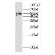 WB analysis of mouse brain tissue, using IGSF21 antibody (1/1000 dilution).