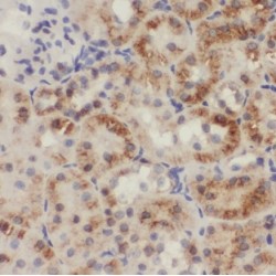 Indian Hedgehog Protein (IHH) Antibody