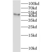 WB analysis of human kidney tissue, using IHH antibody (1/500 dilution).