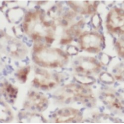 IkB Alpha (IKBA) Antibody