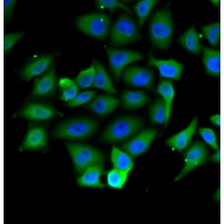 IkB Beta (IKBB) Antibody