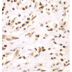 Inhibitor of Nuclear Factor Kappa-B Kinase Subunit Beta / IKKB (IKBKB) Antibody