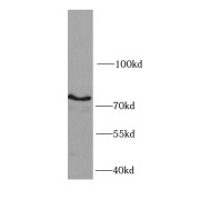 WB analysis of U251 cells, using IKBKB antibody (1/1000 dilution).