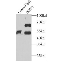 DNA-Binding Protein Ikaros (IKZF1) Antibody