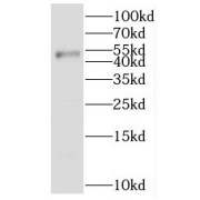 WB analysis of HeLa cells, using IKZF1 antibody (1/500 dilution).