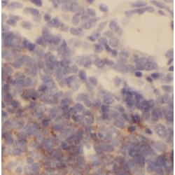 Zinc Finger Protein Helios (IKZF2) Antibody