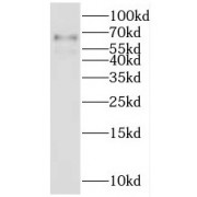 WB analysis of Jurkat cells, using IKZF3 antibody (1/300 dilution).