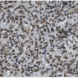 Zinc Finger Protein Aiolos (IKZF3) Antibody