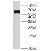 WB analysis of Jurkat cells, using IKZF3 antibody (1/300 dilution).