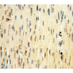 Interleukin-1 Beta (IL1B) Antibody