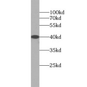 WB analysis of A549 cells, using IL1B antibody (1/1000 dilution).