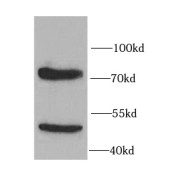 WB analysis of MCF7 cells, using IL10RA antibody (1/1000 dilution).