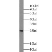 WB analysis of human plasma tissue, using IL11 antibody (1/500 dilution).