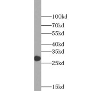 WB analysis of Recombinant protein, using IL12A antibody (1/2000 dilution).