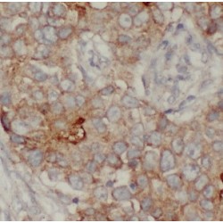 Interleukin 13 Receptor Alpha 2 (IL13RA2) Antibody