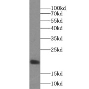 WB analysis of U-937 cells, using IL17A antibody (1/500 dilution).