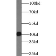 WB analysis of human brain tissue, using IL17F antibody (1/1000 dilution).