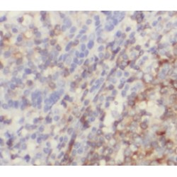 Interleukin 19 (IL-19) Antibody