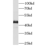 WB analysis of HeLa cells, using IL1R2 antibody (1/1000 dilution).