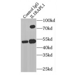 Interleukin 1 Receptor Accessory Protein Like 1 (IL1RAPL1) Antibody