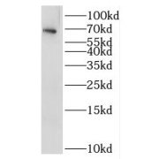 WB analysis of K-562 cells, using IL1RL2 antibody (1/300 dilution).