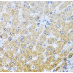 Interleukin 20 (IL20) Antibody