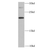 WB analysis of mouse liver tissue, using IL20 antibody (1/1000 dilution).