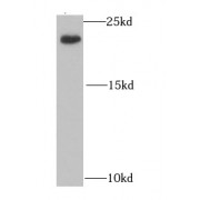 WB analysis of mouse liver tissue, using IL21 antibody (1/1000 dilution).