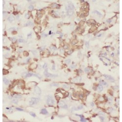 Interleukin 22 Receptor Alpha 2 (IL22RA2) Antibody