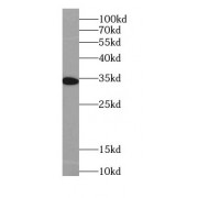 WB analysis of Raji cells, using IL22RA2 antibody (1/1000 dilution).