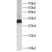 WB analysis of IL27 fusion protein, using IL27 antibody (1/5000 dilution).