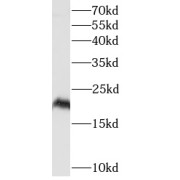 WB analysis of GST tagged recombinant IL29 protein, using IL-29 antibody (1/10000 dilution).