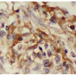 Interleukin 32 (IL32) Antibody