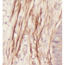 Interleukin 36 Gamma / IL1F9 (IL36G) Antibody
