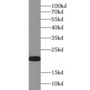 WB analysis of Transfected HEK-293 cells, using IL1F9 antibody (1/500 dilution).