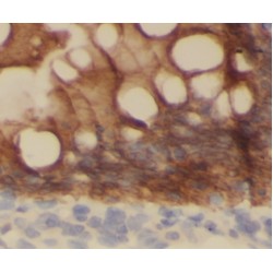 Interleukin 37 (IL37) Antibody