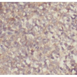 Interleukin 4 (IL-4) Antibody